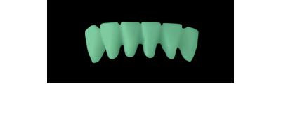 Ref.C10Facing : 1x  wax facing-bridge,  MEDIUM, Aligned, TOOTH 43-33, compatible with Ref.A10Lingual,(43-33), for long-term provisionals preparation